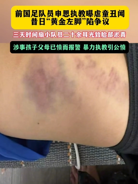 前国脚申思掌掴小球员视频曝光 家长已报警 前国脚申思掌掴小球员视频曝光 家长已报警
